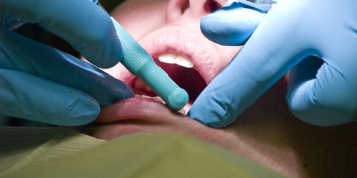 dental-operation